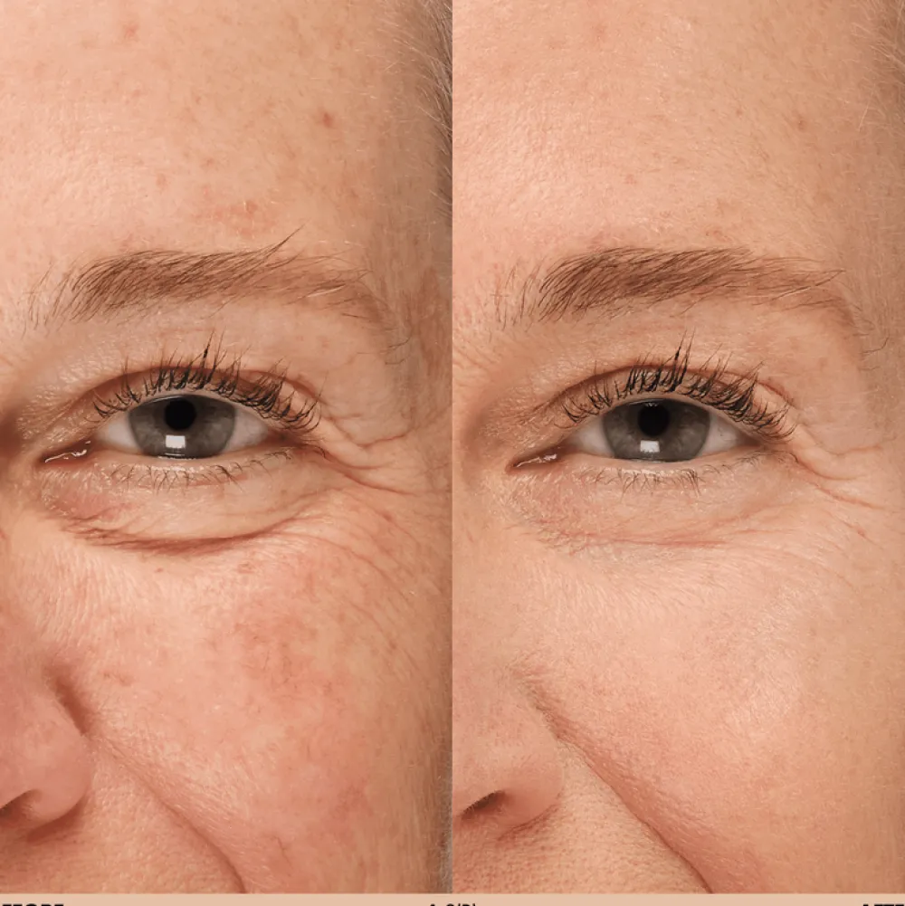 Correctores*Make Up For Ever 1.2 (R) HD Skin Concealer